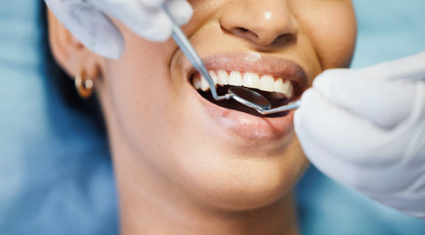 Best Emergency Tooth Extraction in Hot Springs, SD